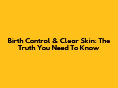 Birth Control & Clear Skin: The Truth You Need To Know