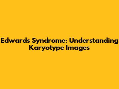 Edwards Syndrome: Understanding Karyotype Images