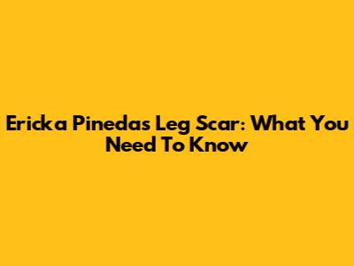 Ericka Pineda's Leg Scar: What You Need To Know