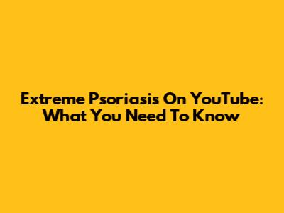Extreme Psoriasis On YouTube: What You Need To Know